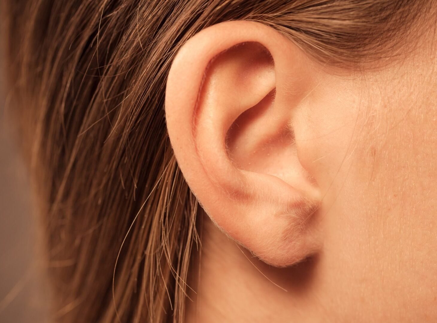 Protruding Ears e1751331211603