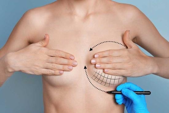 breast augmentation in karachi 3 dr zia plastic surgery 6530f8a681d5f