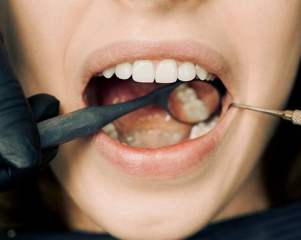 dentist checking teeth of a person 12148417 1024x815 1